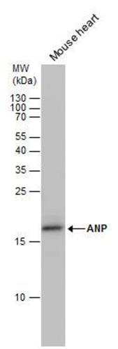 PIPA529559 | Invitrogen Antigen ANP Host Species Rabbit Target
