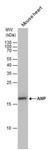 PIPA529559 | Invitrogen Antigen ANP Host Species Rabbit Target
