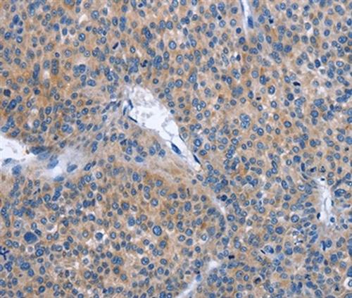 PA550633 | Invitrogen Antigen IBSP Host Species Rabbit Target