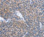 PA550633 | Invitrogen Antigen IBSP Host Species Rabbit Target