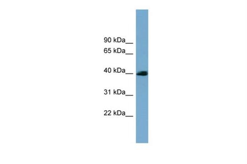 PIPA570305 | Invitrogen Antigen SASH3 Host Species Rabbit Targe