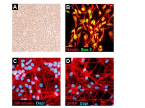 SCC008 | MilliporeSigma Chemicon ReNcell VM Human Neural Pr