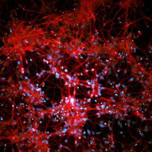 SCC035 | MilliporeSigma Human iPSC Derived Neural Progenito