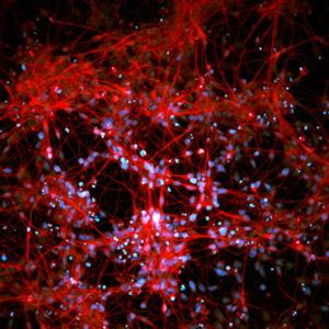 SCC035 | MilliporeSigma Human iPSC Derived Neural Progenito