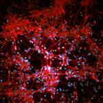 SCC035 | MilliporeSigma Human iPSC Derived Neural Progenito