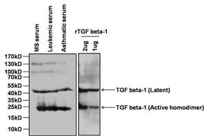 PIMA1169 | Tgfb 1 Antibody B11 4c3