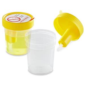 3841 | Urine Transfer Straw 3 Inch Straw 7.5cm Non Steril