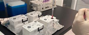 SB3010 | SeptiCyte RAPID Box 6 Cartridges