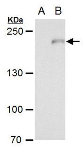 PA521349 | COMPLEMENT C3 ANTIBODY EA