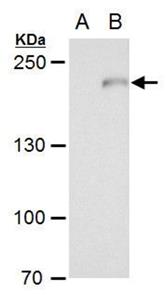 PA521349 | COMPLEMENT C3 ANTIBODY EA