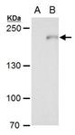 PA521349 | COMPLEMENT C3 ANTIBODY EA