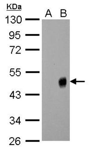 PA532238 | INFLUENZA A H1N1 NA ANTIBODY EA