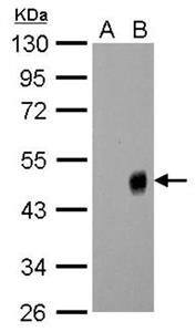 PA532238 | INFLUENZA A H1N1 NA ANTIBODY EA