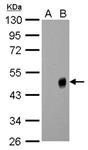 PA532238 | INFLUENZA A H1N1 NA ANTIBODY EA