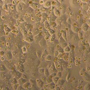 HH1 | Primary Human Hepatocytes - Plateable Grade 