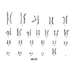 K02 | Karyotype service from live human cells, BSL1