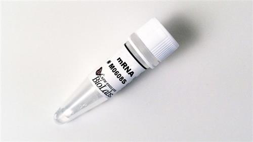 M0608S | mRNA Decapping Enzyme 2000 units