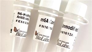 E1610S | EpiMark N6 Methyladenosine Enrichment Kit 20 react