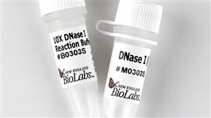 M0303S | DNase I RNase free 1000 units