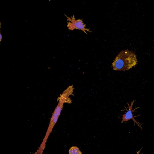 PMIDIF11 | The PhenoVue ™ Microglia Differentiation Staining Kit 1 x 384 comprises a set of validated, optimized and ready-to-use fluorescent probes to vizualize microglia cell in brain cells populations and to monitor microglia differentiation process from progenitors. The kit is validated for use on high-content screening systems such as the Opera Phenix™ Plus high content screening system.