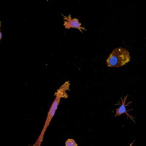 PMIDIF11 | The PhenoVue ™ Microglia Differentiation Staining Kit 1 x 384 comprises a set of validated, optimized and ready-to-use fluorescent probes to vizualize microglia cell in brain cells populations and to monitor microglia differentiation process from progenitors. The kit is validated for use on high-content screening systems such as the Opera Phenix™ Plus high content screening system.