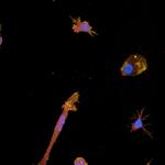 PMIDIF11 | The PhenoVue ™ Microglia Differentiation Staining Kit 1 x 384 comprises a set of validated, optimized and ready-to-use fluorescent probes to vizualize microglia cell in brain cells populations and to monitor microglia differentiation process from progenitors. The kit is validated for use on high-content screening systems such as the Opera Phenix™ Plus high content screening system.