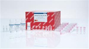 74134 | RNeasy Plus Mini Kit (50)