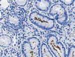 8317-C010 | Tissue Tek Genie anti Helicobacter Pylori Rabbit M