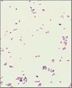 9990721 | Kit Gram Stain 125ML
