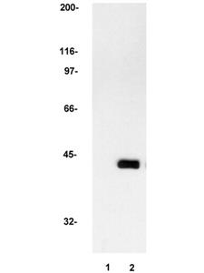 05-157 | ANTI MAP KINASE 2 ERK2 ANTIBODY CLONE 1B3B9