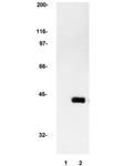 05-157 | ANTI MAP KINASE 2 ERK2 ANTIBODY CLONE 1B3B9