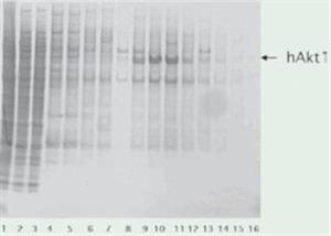 11873580001 | COMPLETE TM EDTA FREE PROTEASE INHIBITOR COCKTAIL