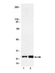 17-218 | RAS ACTIVATION ABETAAY KIT