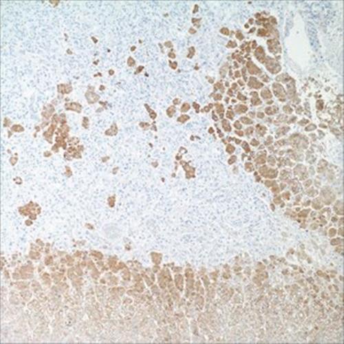 271M-18 | INHIBIN ALPHA R1 7ML PREDILUTE