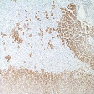 271M-18 | INHIBIN ALPHA R1 7ML PREDILUTE