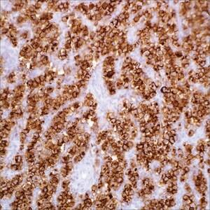 321M-18 | PLAP NB10 7ML PREDILUTE