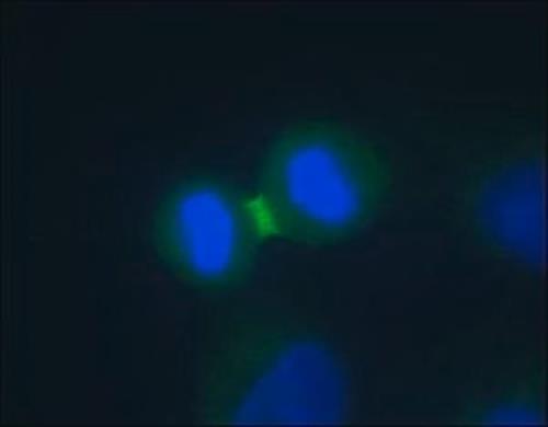 A5102-200UL | ANTI AURORA B DEVELOPED IN RABBIT IGG FRACTION OF