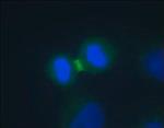 A5102-200UL | ANTI AURORA B DEVELOPED IN RABBIT IGG FRACTION OF