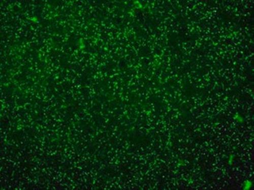 AB144P | ANTI CHOLINE ACETYLTRANSFERASE ANTIBODY