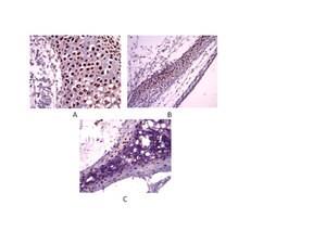 AB5535 | ANTI SOX9 ANTIBODY