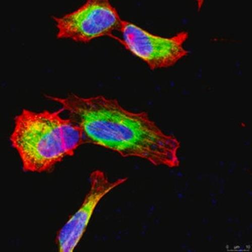 MAB348-100UL | ANTI APP A4 ANTIBODY A.A. 66 81 OF APP