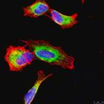 MAB348-100UL | ANTI APP A4 ANTIBODY A.A. 66 81 OF APP