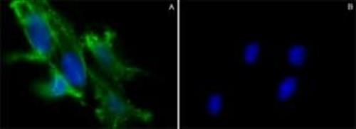SAE0069-500UG | CHOLERA TOXIN B SUBUNIT RECOMBINANT EXPRESSED IN H