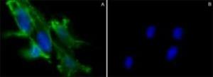 SAE0069-500UG | CHOLERA TOXIN B SUBUNIT RECOMBINANT EXPRESSED IN H