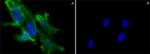 SAE0069-500UG | CHOLERA TOXIN B SUBUNIT RECOMBINANT EXPRESSED IN H