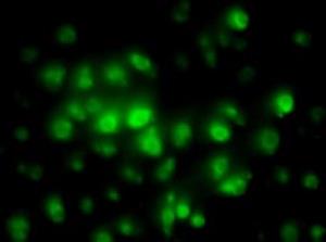 SCC131 | A2EN HUENDOCERVICAL EPITHELIAL CELL LINE