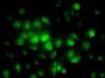SCC131 | A2EN HUENDOCERVICAL EPITHELIAL CELL LINE