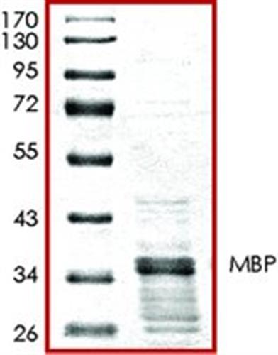 SRP5205-50UG | MBP GST TAGGED HUMAN