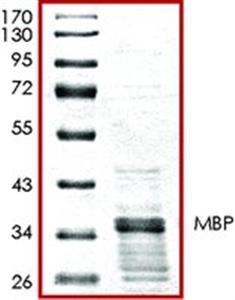SRP5205-50UG | MBP GST TAGGED HUMAN