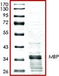 SRP5205-50UG | MBP GST TAGGED HUMAN